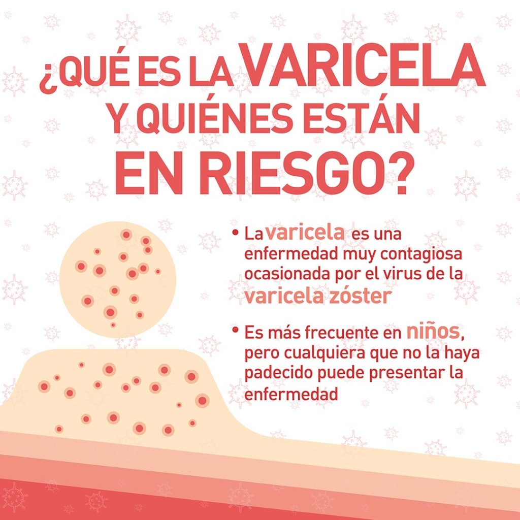 Infografia-Varicela-thumb